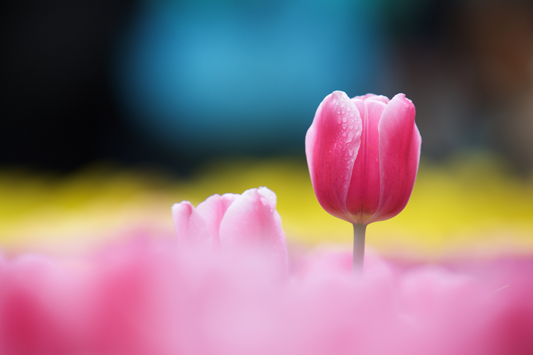 Vajinoplasti Ameliyatı Nedenleri: Neden Tercih Ediliyor?